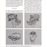 Rhinocolobus Turkanaensis KNM-ER 1485 Skull