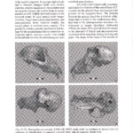 Theropithecus Oswaldi KNM-ER 18925 Skull
